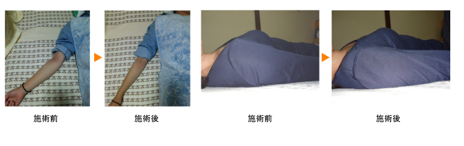 テニス肘　巻肩などもお気軽に。