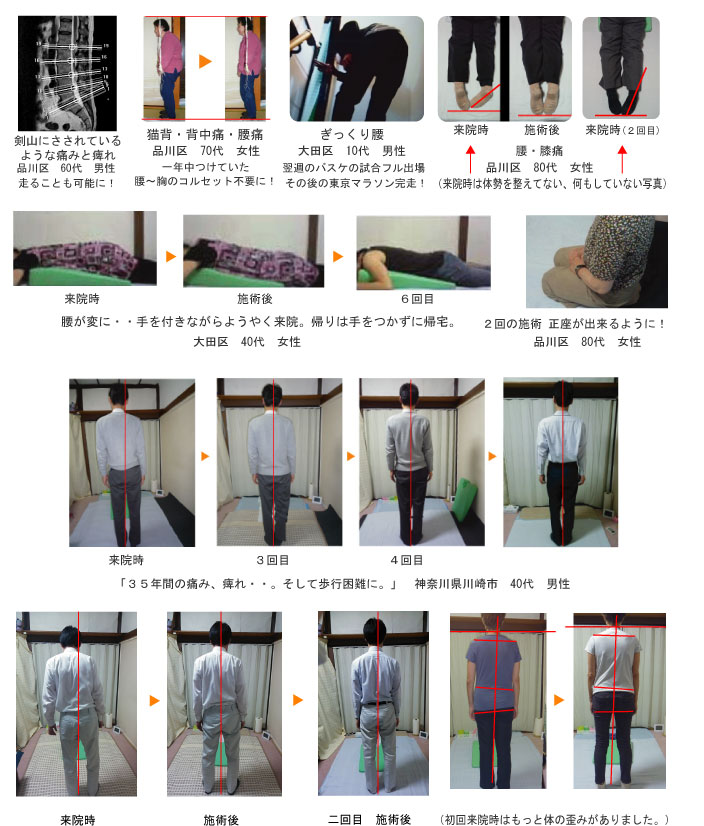 腰痛、痺れ、ぎっくり腰の方
