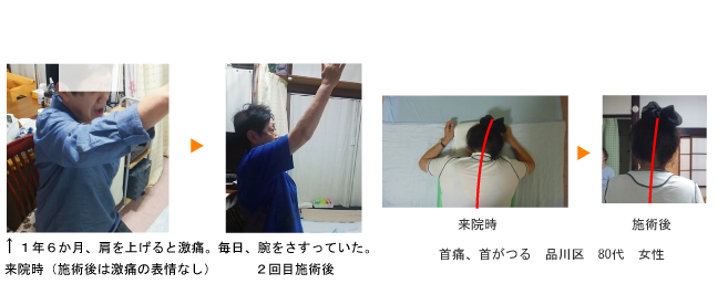 四十肩、五十肩、首痛