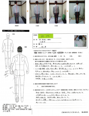 腰痛歴 35年 痺れ、痛み