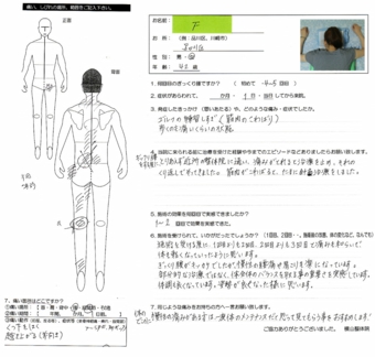 ぎっくり腰、痺れ 前屈、くつ下をはく、起き上がるが痛い